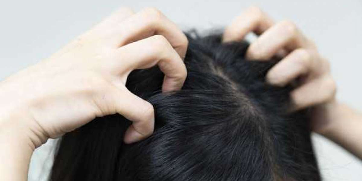 Home Remedies For Dry Hair And Scalp
