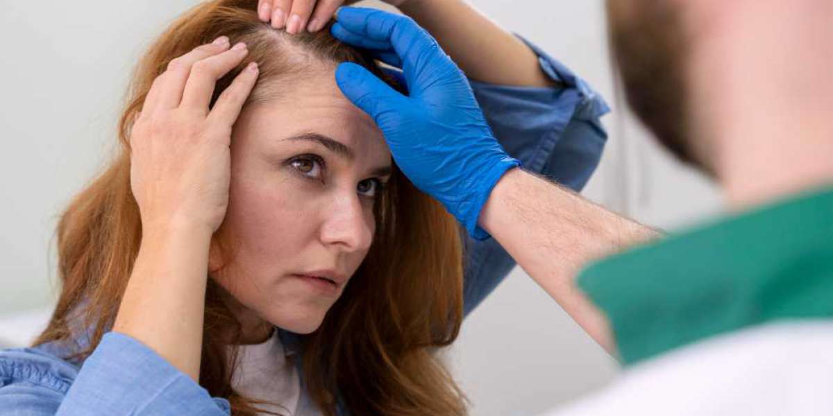 The Benefits of The Best PRP Hair Treatment in Dubai