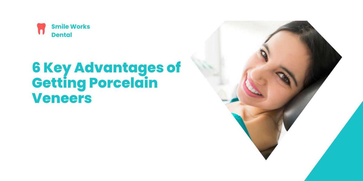 6 Key Advantages of Getting Porcelain Veneers