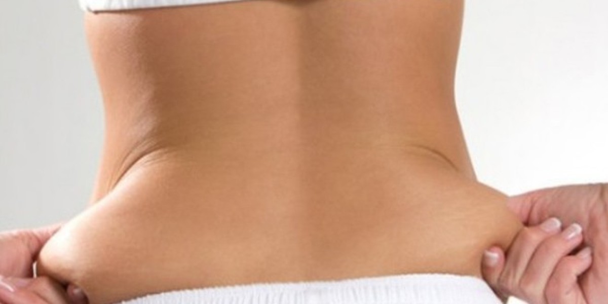 Improve Waist Contour with Love Handles Liposuction