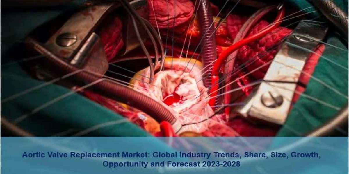 Aortic Valve Replacement Market 2023 | Size, Scope, Growth, Demand And Forecast 2028