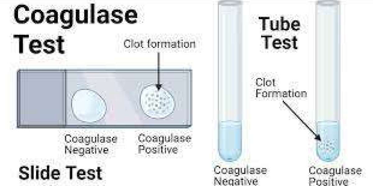 Coagulase Test- Its Principle, Procedure, Types and Interpretation