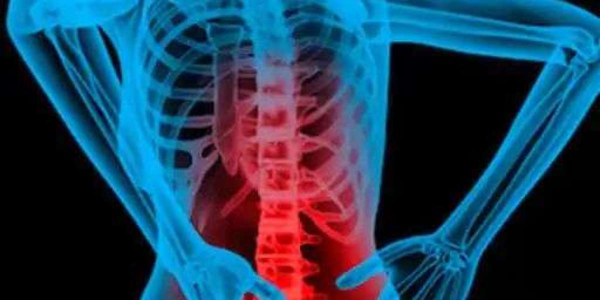 Why Etadol 100mg is the Best Choice for Severe Pain Management