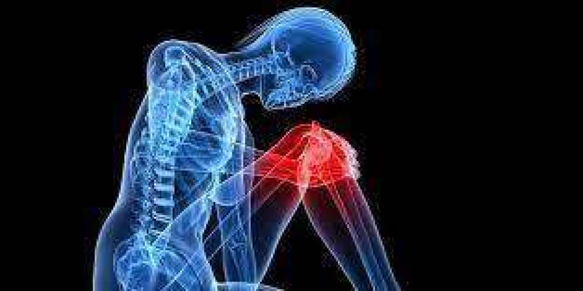 The Ultimate Solution for Muscle Pain: Pain O Soma 500mg Unveiled!