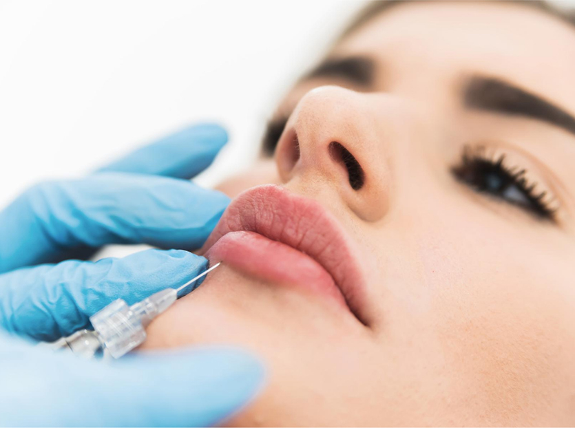 Dermal Fillers | Restore Your Youth | Maya Medi Spa