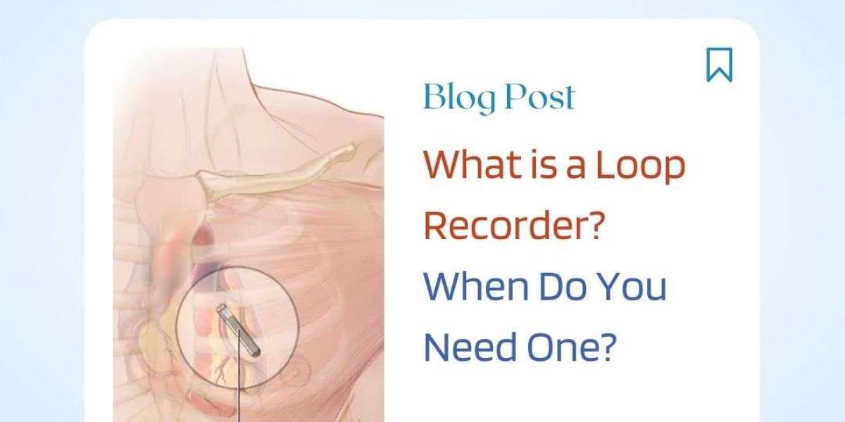What Is Loop Recorder