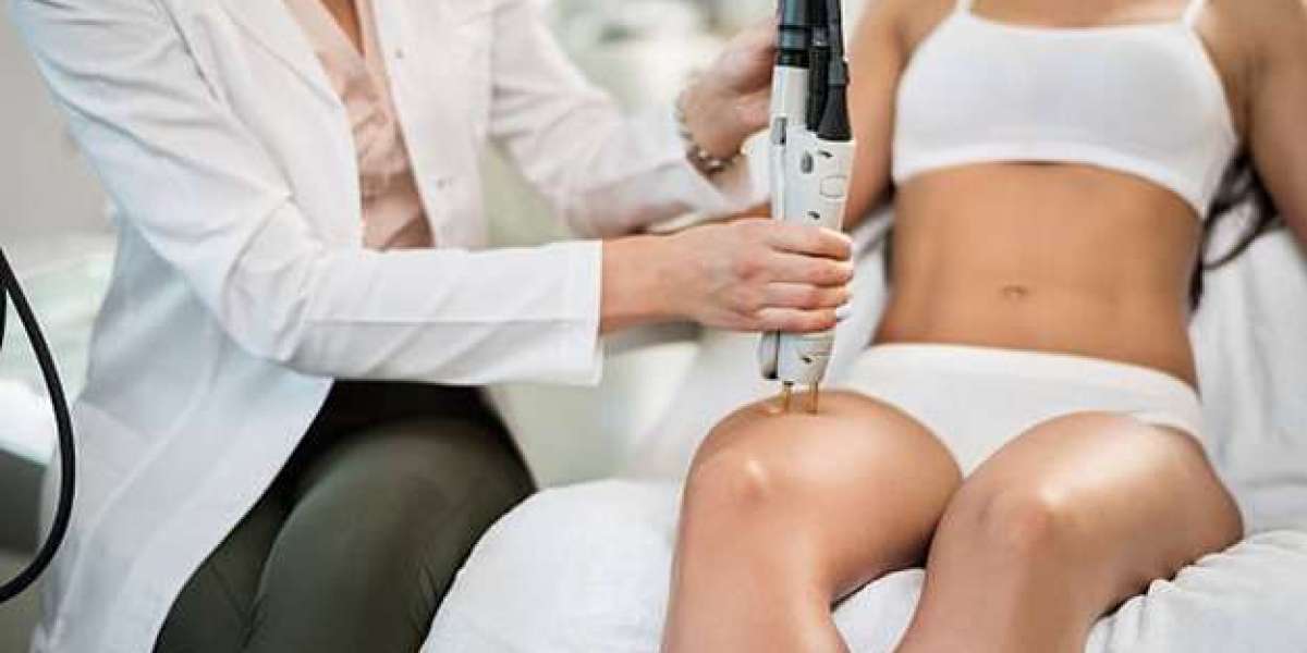 Electrolysis in Toronto: A Comprehensive Guide