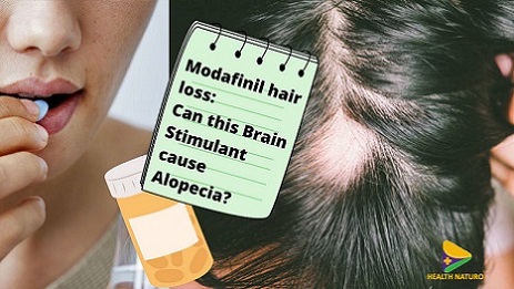 Modafinil hair loss: Can this brain stimulant cause alopecia?