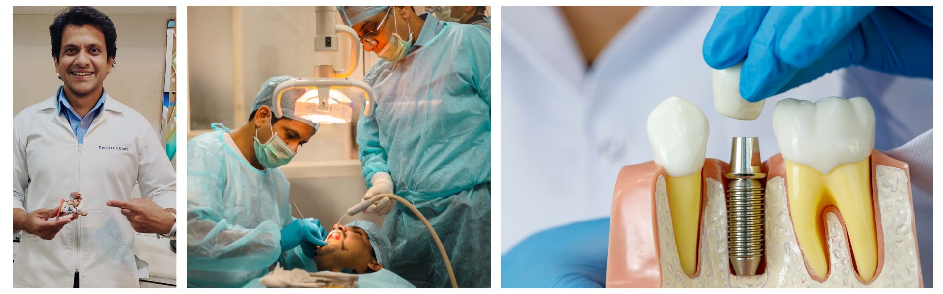 Best Dental implant treatment in Jogeshwari & Andheri, Mumbai