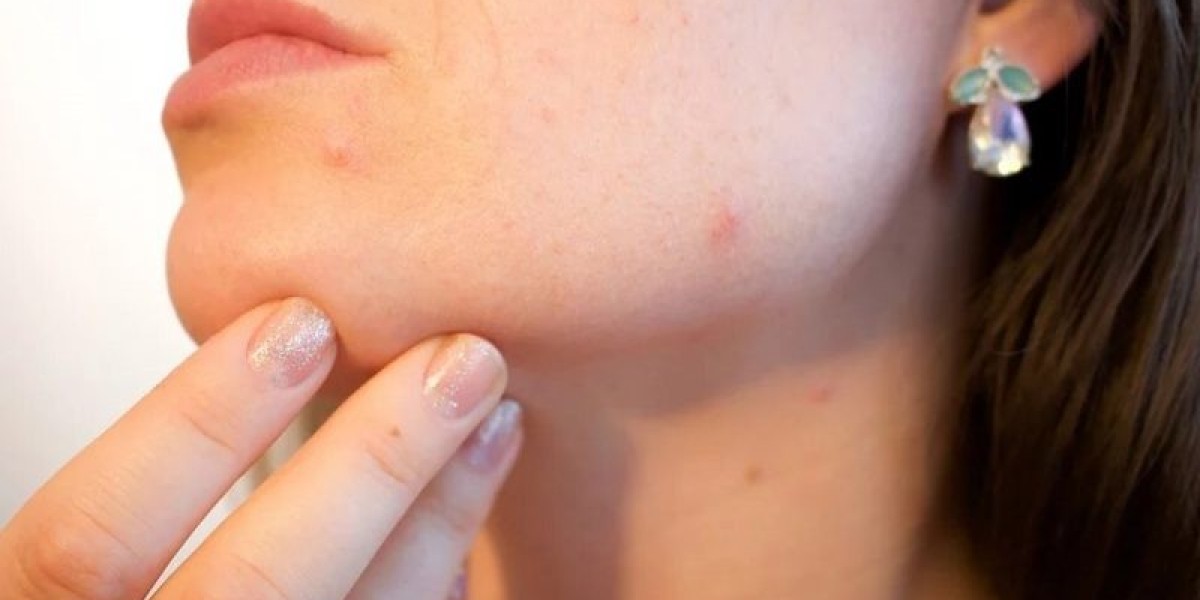 Unlocking the Secrets of Skin Health: A Journey with Skin Specialist Doctors in Jaipur