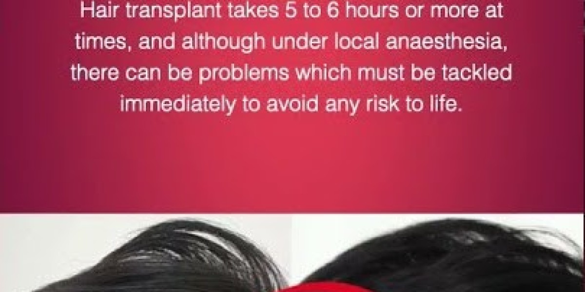 Sirpi: Your Premier Destination for Aesthetic Clinic and Hair Transplant in Coimbatore