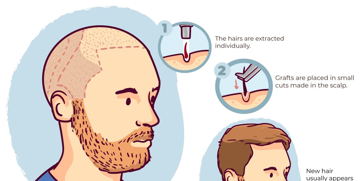 Some Common Side Effects Associated with Cysteine Hair Treatment