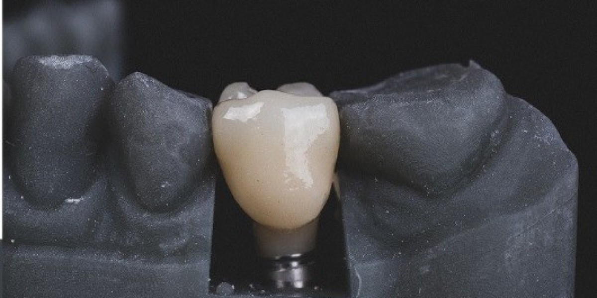 Why Dentists In Malvern East Are The Perfect Choice For Your Dental Health