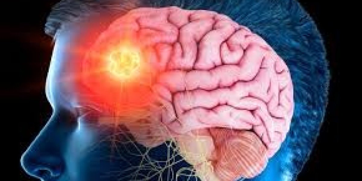 Overcoming Stigma: Open Conversations About Brain Cancer