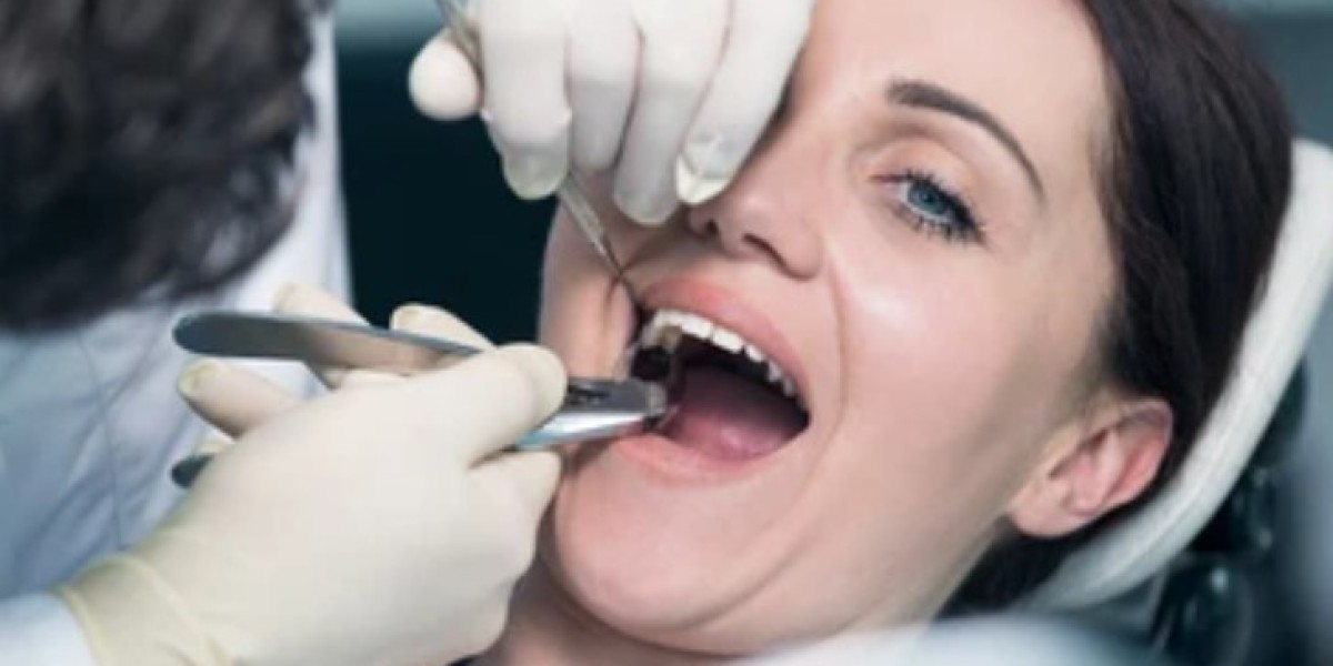 From Pain to Relief: Transforming Smiles with Local Root Canals Near Me