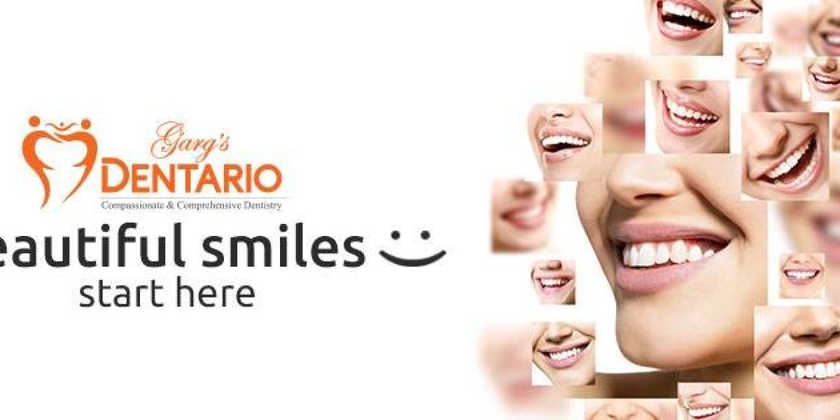 Teeth Whitening: How It Works, Types, and Side Effects