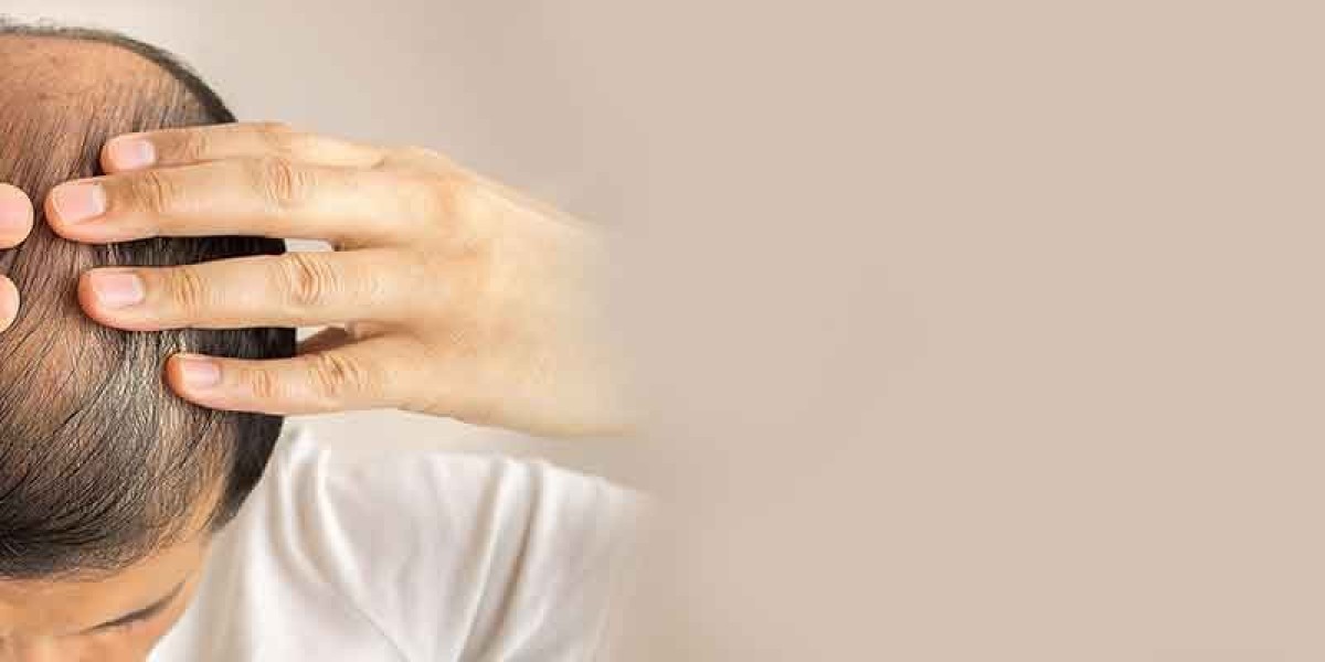What Causes Hair Fall in Females?