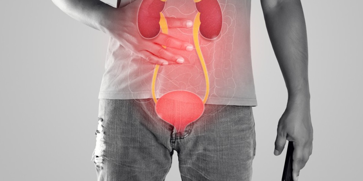 Kidney Stone Treatment in Pune: Expert Care with Dr. Abhijit Gokhale