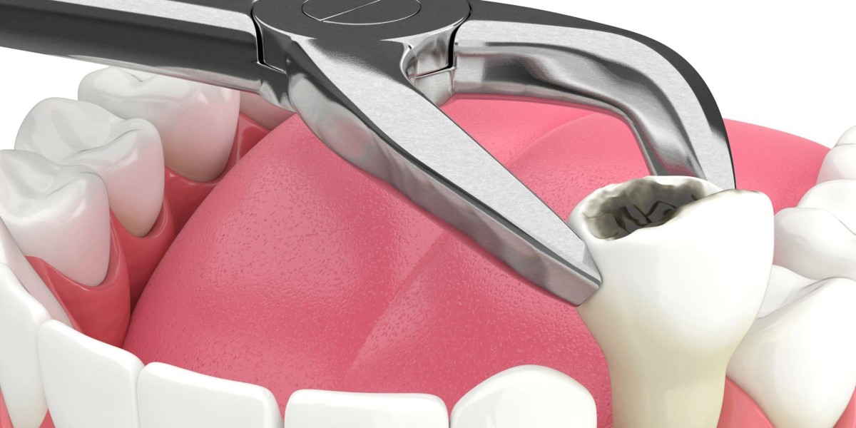 Painless Precision: San Dimas Dental's Expert Tooth Extraction in Bakersfield