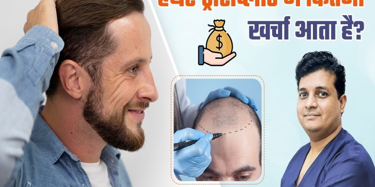 Exploring the Root Cause of Hair Loss in Men Understanding Causes and Myths