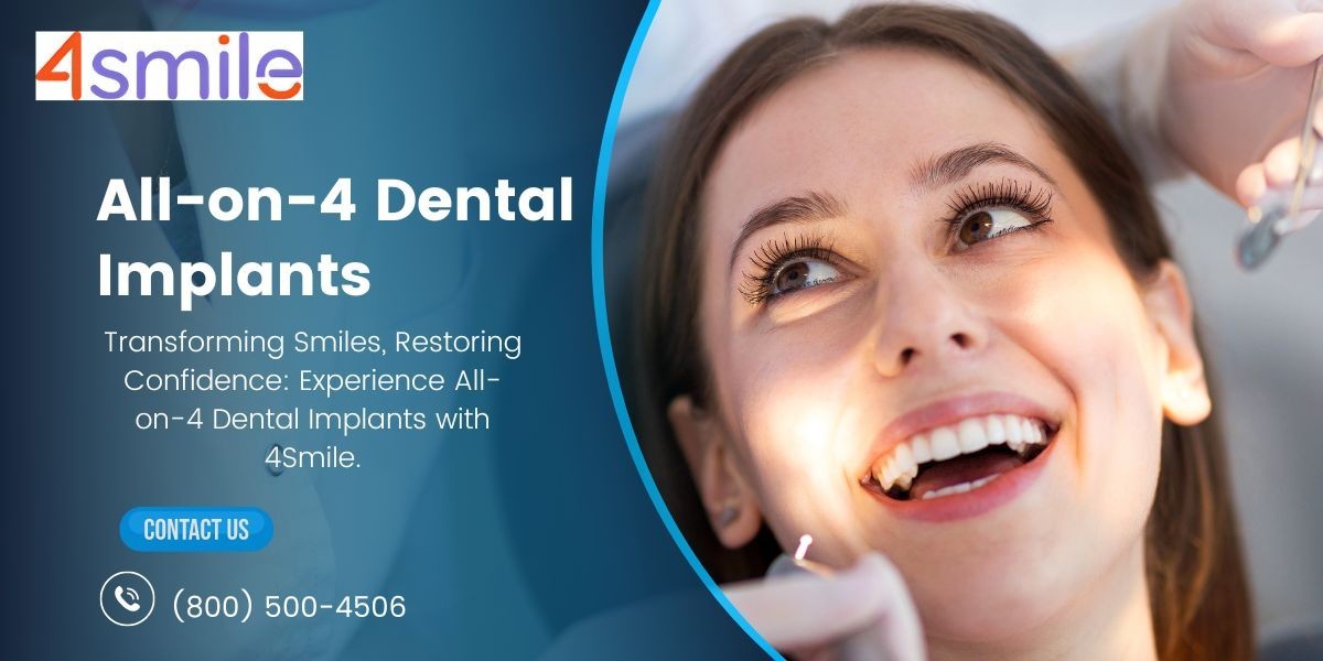 Revitalize Your Smile: Unveiling the Power of All-on-4 Dental Implants with 4Smile.
