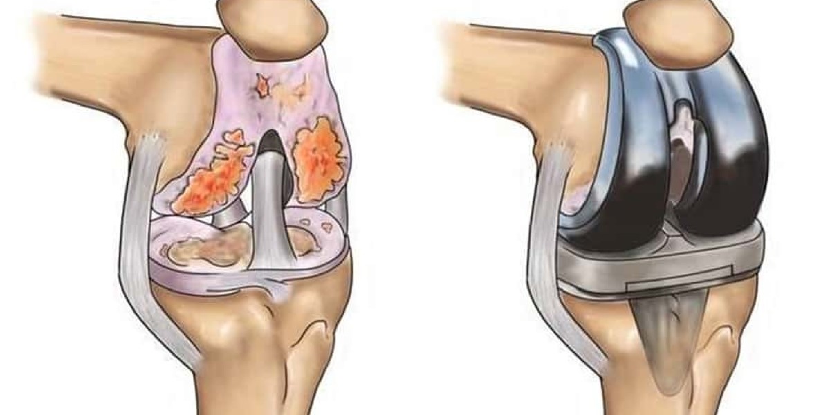 Finding the Best Knee Specialist in Pimpri Chinchwad Pune: Dr. Sushil Kulkarni