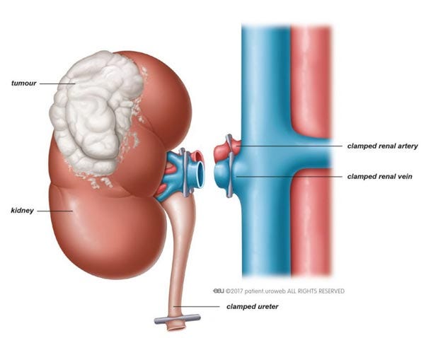 Advanced Bladder Cancer Treatment at Guru Jambheshwar Multispeciality Hospital, Hisar | by Jahnvi Sharma | Jun, 2024 | Medium