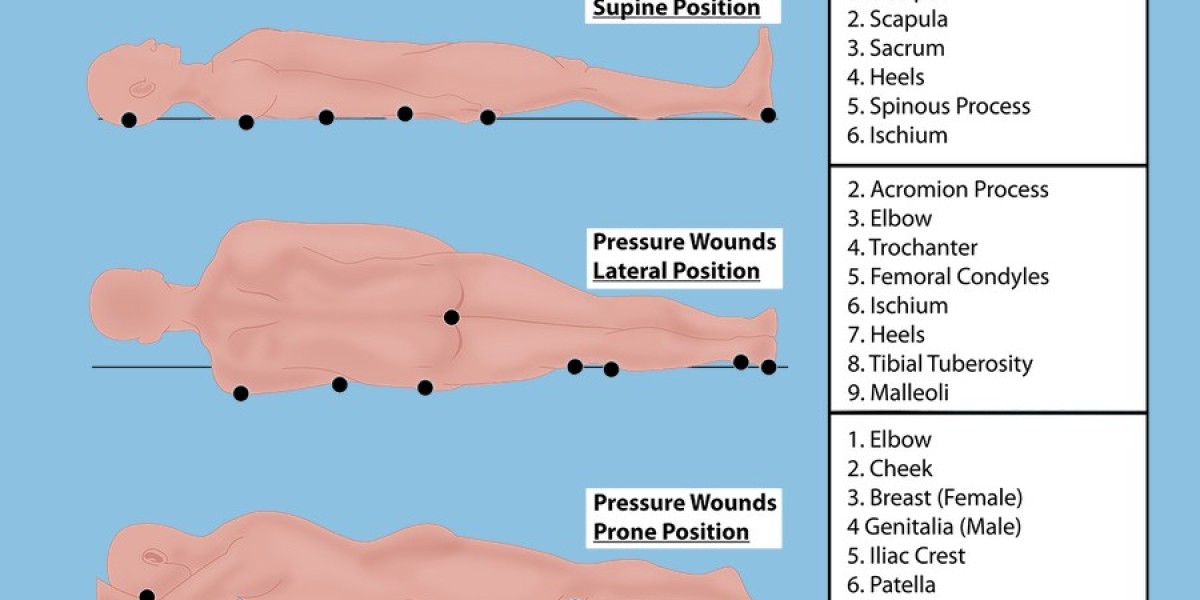 Leg Infection in Diabetics: Understanding Arterial Leg Ulcers and Diabetic Foot Infections!