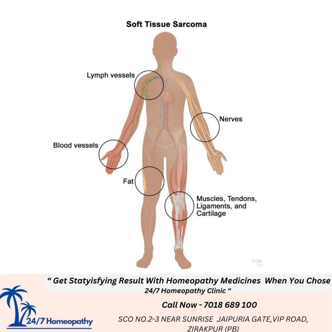 EWING SARCOMA - 247homeopathy
