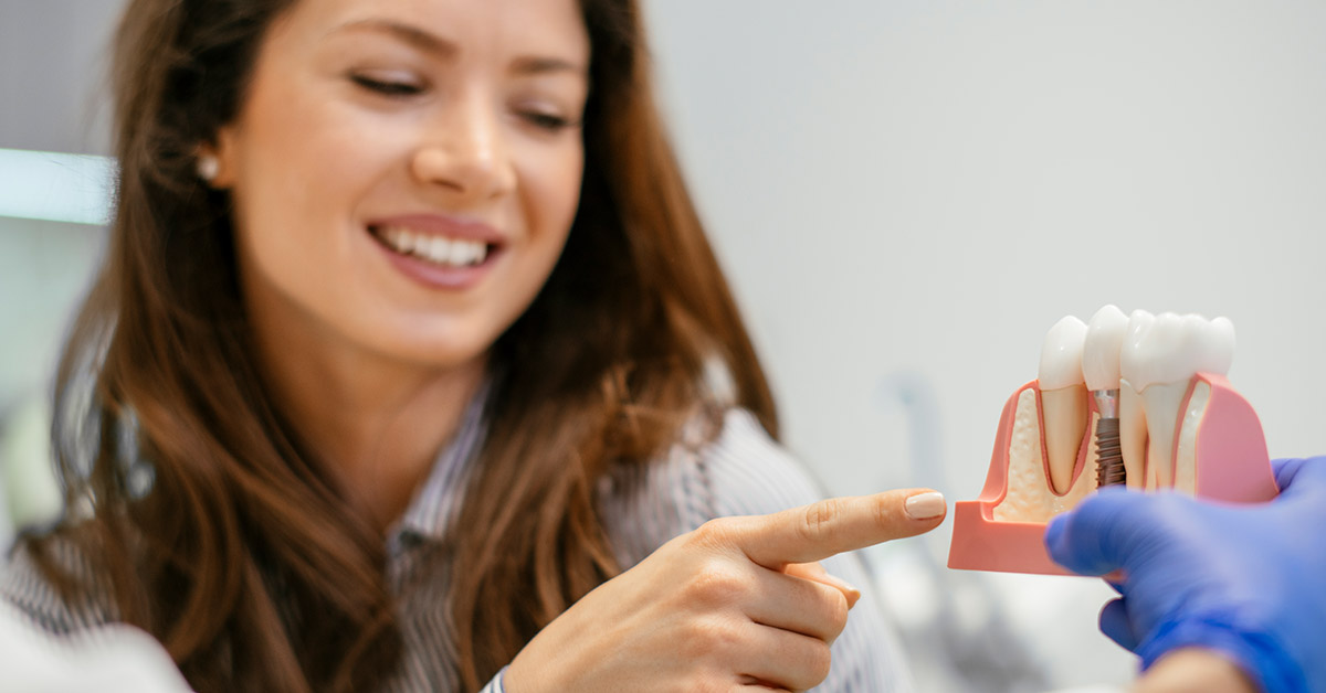 All About Dental Care in Oakville: Spotlight on Implants – Brass Smile