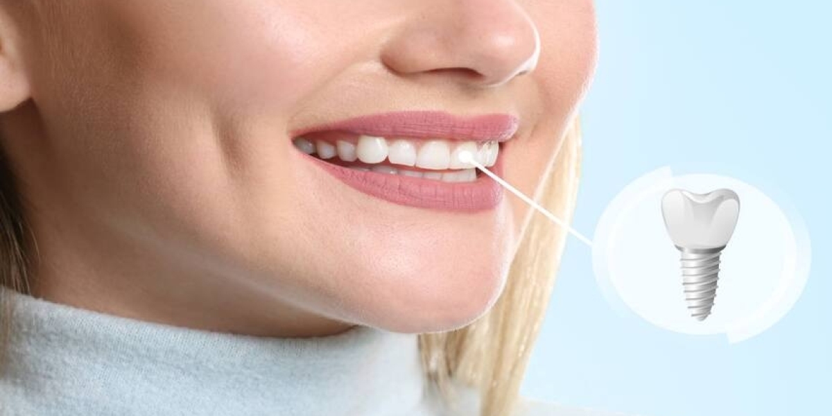 Combining Invisalign Treatment in the UK with Advanced Gum Treatment Techniques