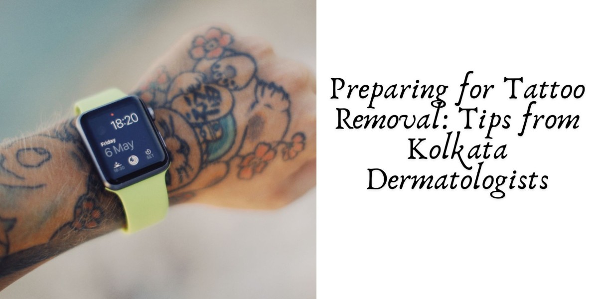 Preparing for Tattoo Removal: Tips from Kolkata Dermatologists
