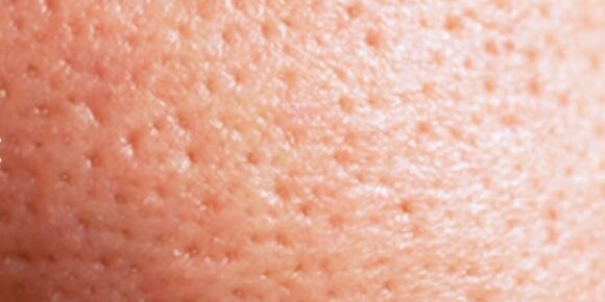 Everything One Needs To Know About Open Pores