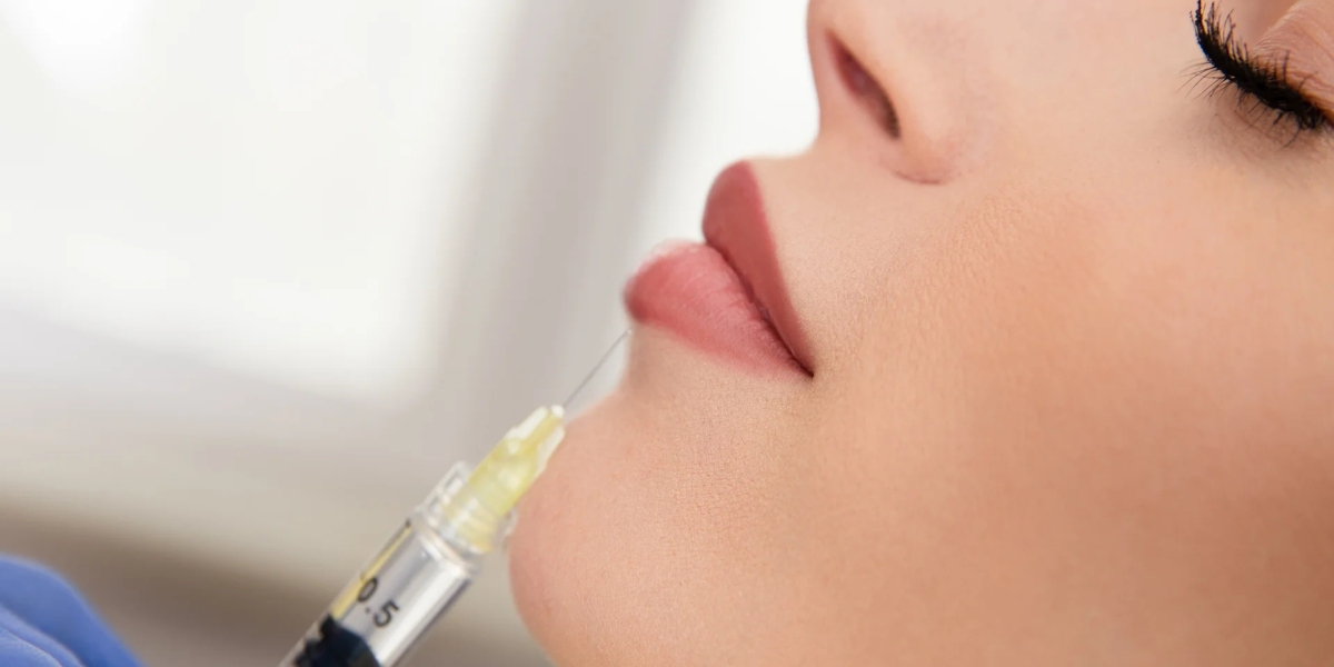How to Communicate Your Desired Lip Shape to Your Injector