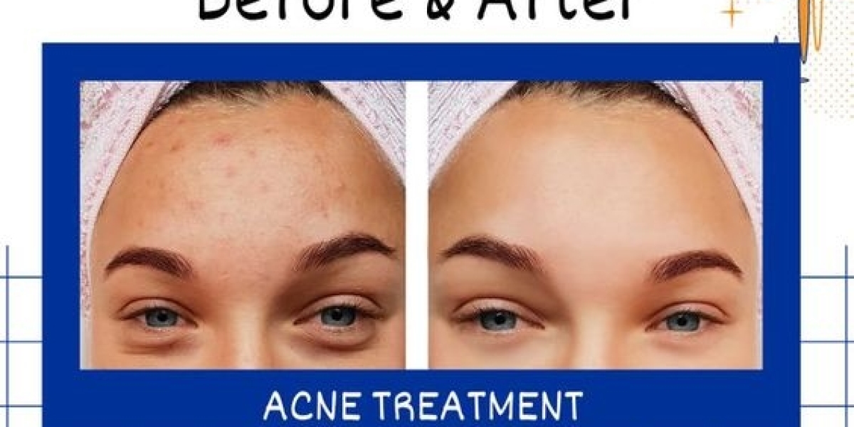 The Ultimate Guide to Finding the Best Hair Specialist in Roorkee