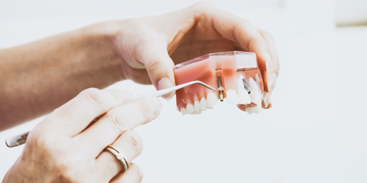 Guide to Choosing the Right Type of Dental Crown