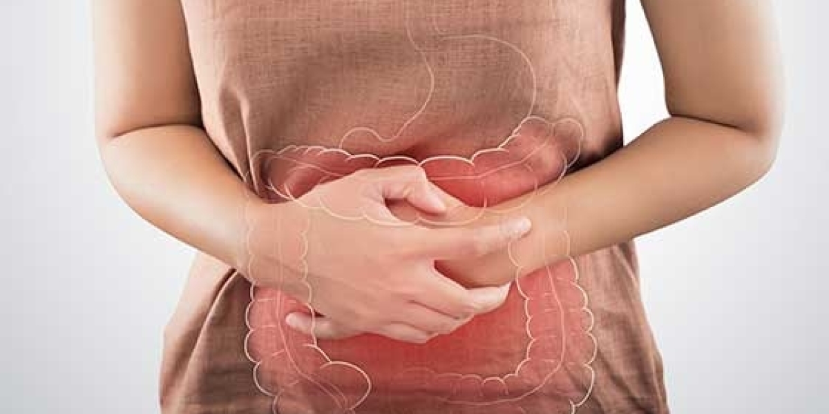 Constipation: Causes, Symptoms, and Treatment