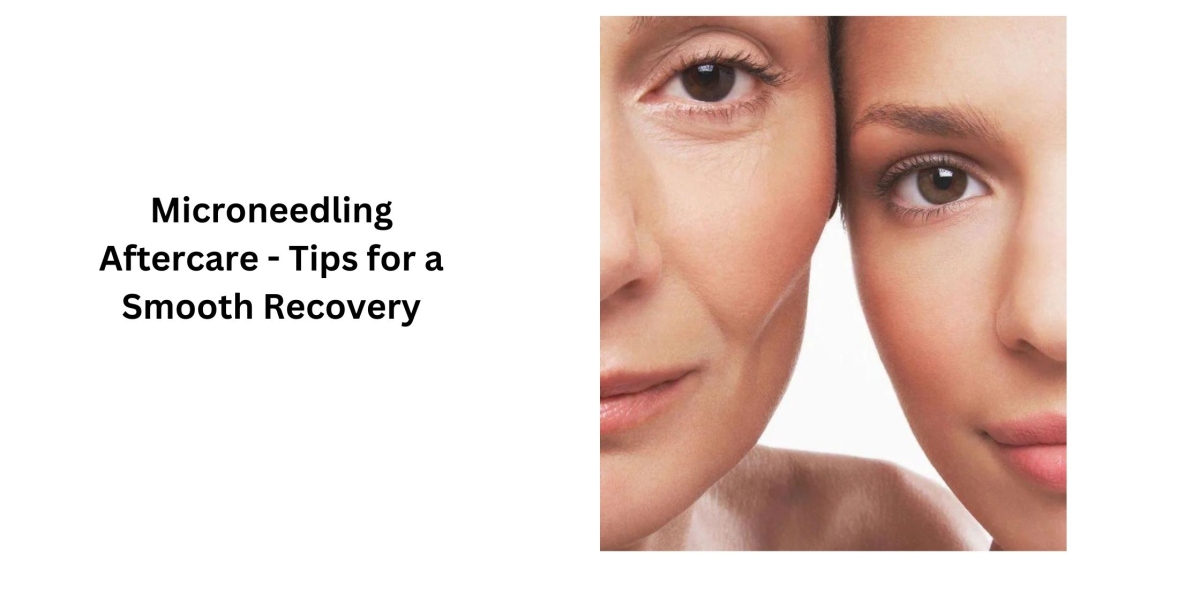 Microneedling Aftercare - Tips for a Smooth Recovery