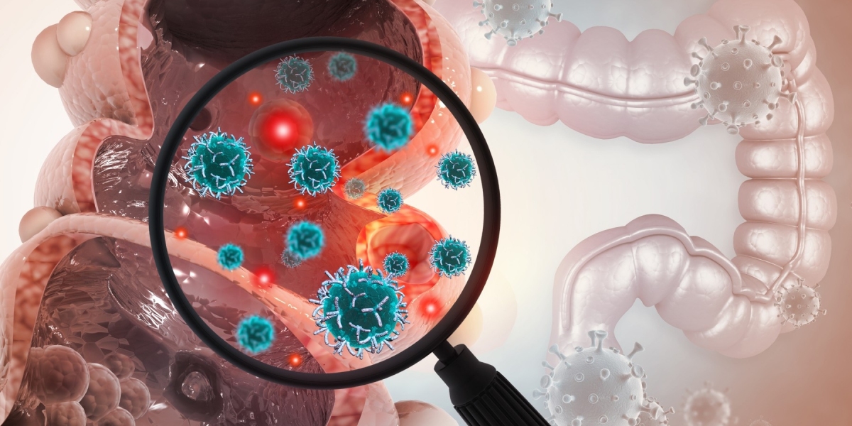 Understanding Colon Cancer Tests: Essential Tools for Early Detection and Prevention