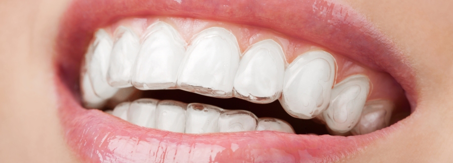 The Cost of Invisalign Treatment Profile Picture