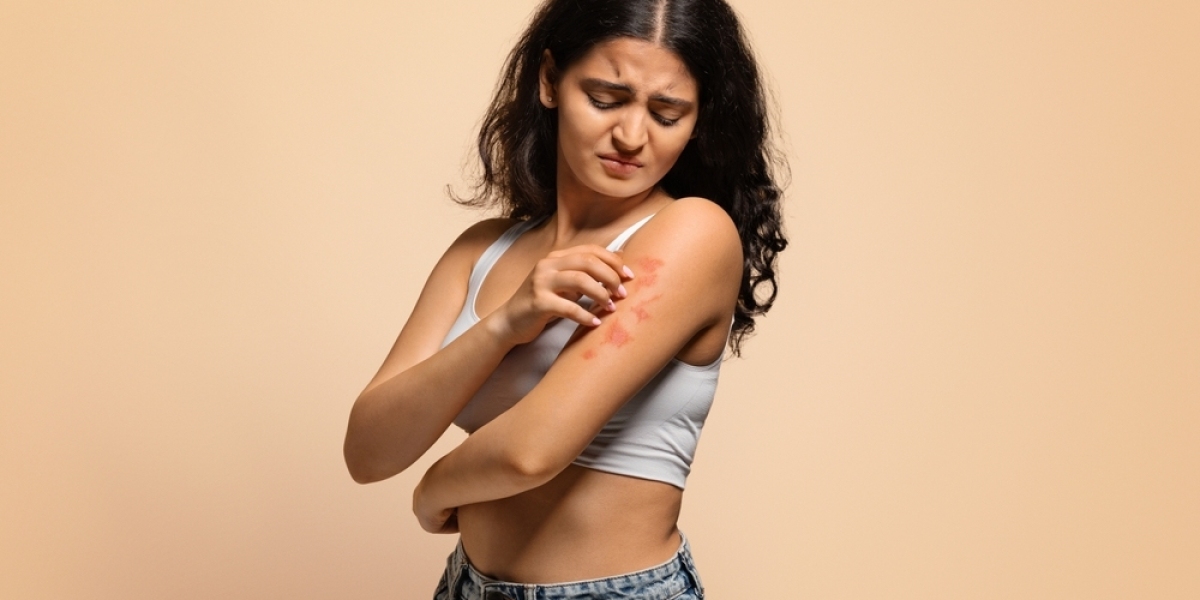 How to Identify and Treat Common Fungal Infections