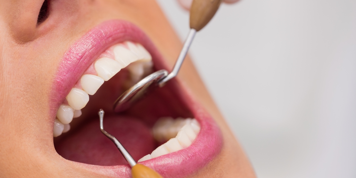The Benefits of Regular Visits to a Dental Hygienist in Kings Cross