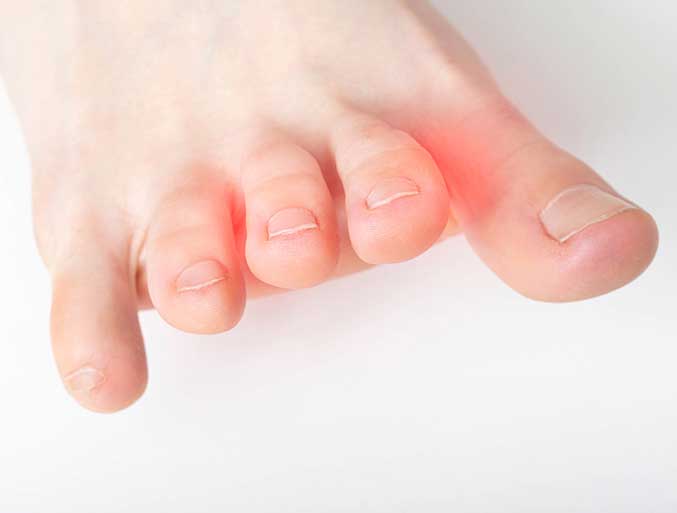 Neuroma in Las Vegas, NV | Treatments for Sciatic Nerve Pain