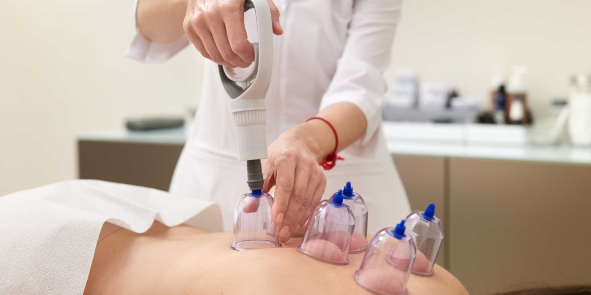 Acupuncture Fertility NYC