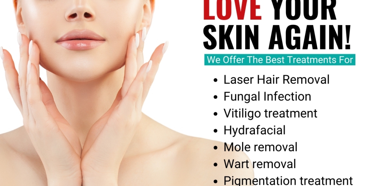 Effective Acne Treatment in Hyderabad | Clear Skin Solutions