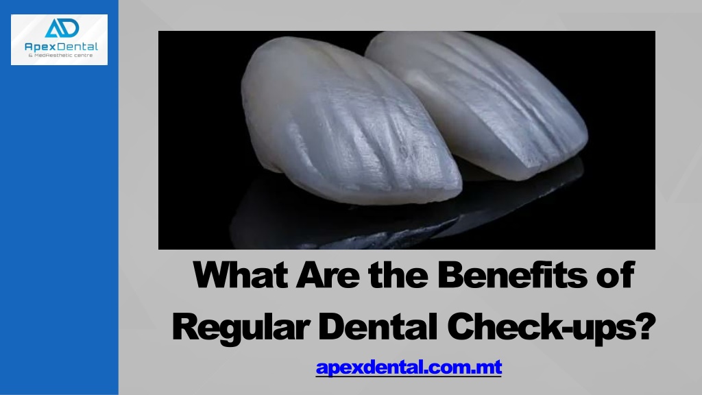 PPT - What Are the Benefits of Regular Dental Check-ups?