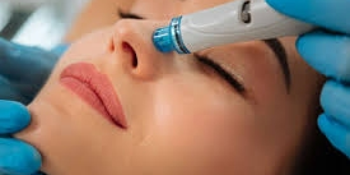 Hydrafacial in Dublin Unveiled: Essential Benefits and Treatment Breakdown