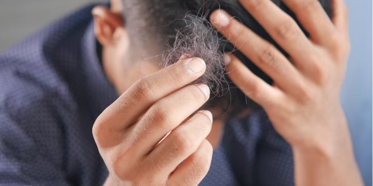 Decoding the Investment: Understanding Hair Transplant London