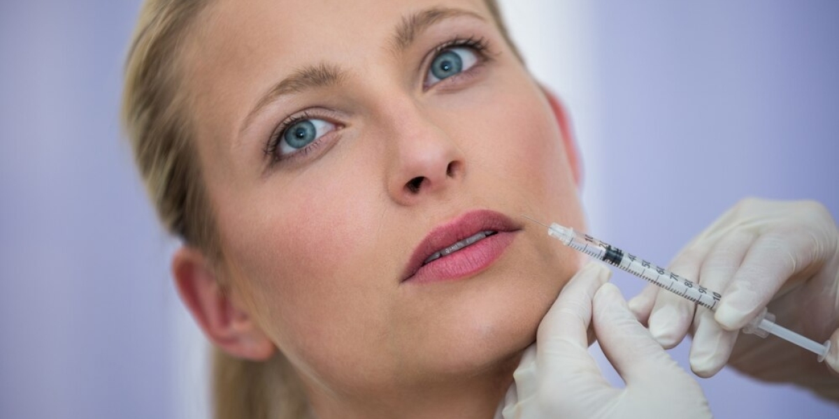 What Can I Do to Make Radiesse Results Last Longer?