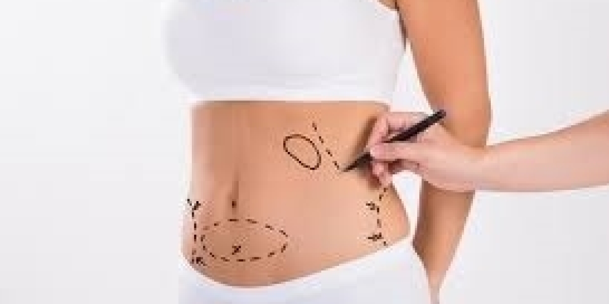 The Ultimate Liposuction Experience in Dubai’s Elite Clinics